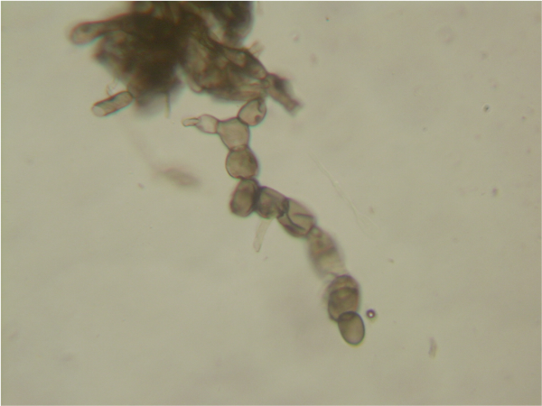 Споры грибка гнили под микроскопом